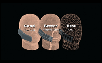 Tecnología XACT-Accurate-Cell